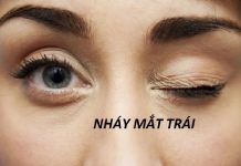 Nháy mắt trái, mắt phải giật